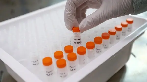 Koronavirusning Omikron oilasiga tegishli FliRT nomli yangi varianti tarqalmoqda